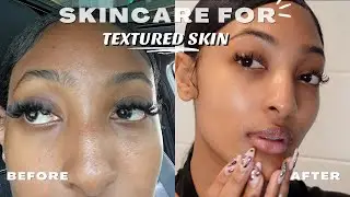 How I Smooth My Textured Skin | Amazon Beauty Must Haves