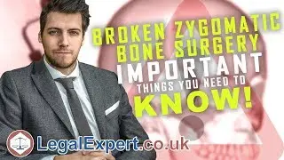 Broken Zygomatic Bone Surgery ( 2020 ) UK
