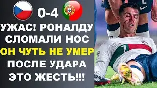 ШОК! РОНАЛДУ СЛОМАЛИ НОС В МАТЧЕ ЧЕХИЯ 0-4 ПОРТУГАЛИЯ. МБАППЕ КОНФЛИКТУЕТ С ФРАНЦИЕЙ. ДЕМБЕЛЕ ВЫБЫЛ