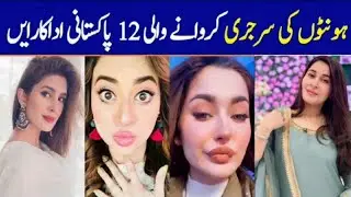 Pakistani Actresses Who Got Lip Fillers Done