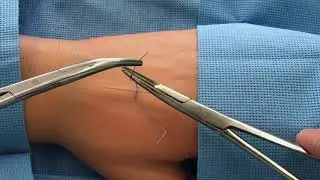 Surgical tie instrument technique / Portiligature