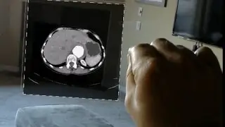 Demonstration 2: Medical Imaging on the HoloLens