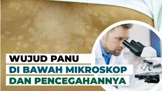 Bagaimana Jamur Panu di Bawah Mikroskop dan Pencegahan Pertubuhannya #temansains