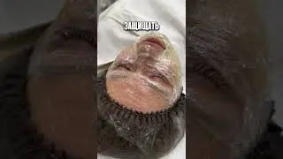 КАК БЫСТРО СПАСТИ КОЖУ ОТ ПОСТАКНЕ И КОМЕДОНОВ? 