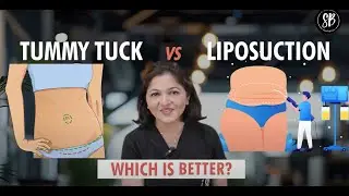 Tummy Tuck vs Liposuction Which is Better? | Tummy Tuck Surgery Vs Liposuction | SB Aesthetics