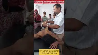 Cupping Therapy