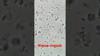Живая сперма