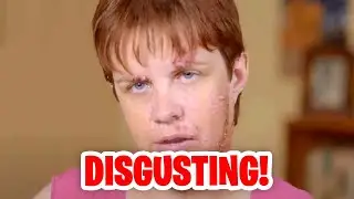 The GROSSEST & MOST DISGUSTING Moments EVER on Dr. Pimple Popper!