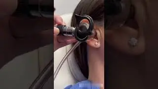 How an ENT Doctor Removes Ear Wax
