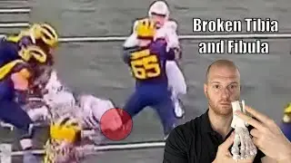 Zak Zinter Injury Update! Zak Zinter Tibia and Fibula Fracture Explained
