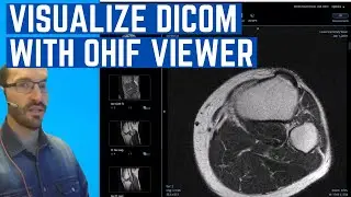 How to Install the OHIF web based DICOM viewer in Docker and connect it to DCM4CHEE