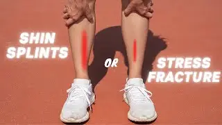 Shin Splints vs Stress Fracture | How to tell the difference!