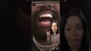 il nuovo sorriso di Kanye West