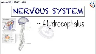 Hydrocephalus and its Types | Nervous System Pathology by Aakansh Kothari