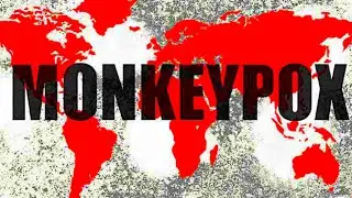 Top 10 Countries with the most monkeypox cases in the world