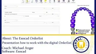 EXOCAD TUTORIAL  Dental-CAD/CAM-FREE-FULL-MOVIE-The Exocad Orderlist-English by Michael Anger