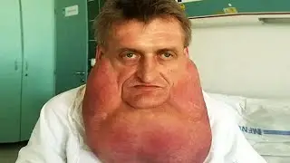RARE HUMANS That Are One in a Million   #11