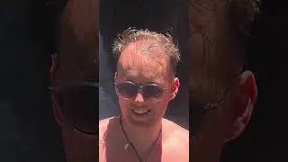 Going Bald Transformation (NO BEARD!)
