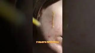 Як прибрати пігментні плями? Вітамін  С у догляді за шкірою