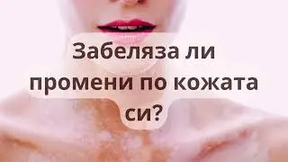 ВИТИЛИГО?