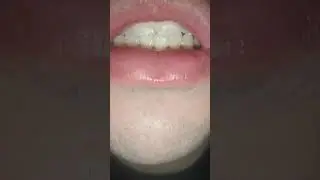 Uvula boy