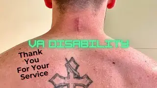 VA Disability (Experienced with it)