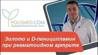 Золото и D-пеницилламин (купренил) при ревматоидном артрите
