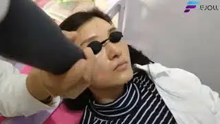 FS60 Portable Picosecond Nd Yag Laser Machine