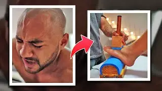 Consertando uma vida inteira de pé chato *PIOR DOR QUE JÁ SENTI*