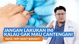 5 Kebiasaan Penyebab Cantengan & Cara Mengatasinya