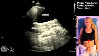 Basic Evaluation of Pelvic Anatomy (Female) using Ultrasound