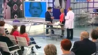 Мешки и круги под глазами - причины и лечение. Как убрать мешки под глазами