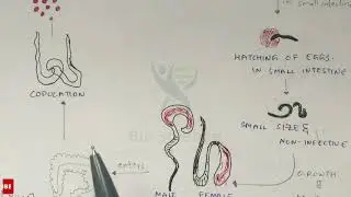 Trichuriasis | Whipworm structure, Life cycle, Symptoms and treatment | Bio science