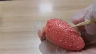 Dil papillaları anatomisi (Papillae linguales anatomisi)