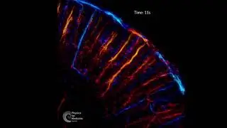 2023 Second Place Video Winner: Functional Ultrasound Localization Microscopy