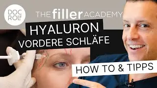 Der beste Weg die VORDERE SCHLÄFE mit HYALURON zu unterspritzen – TFA by doc.rolf