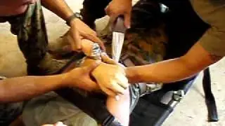 getting duct taped