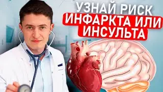Как рассчитать риск инфаркта или инсульта?