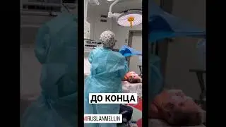 МОЁ ЛИЦО ПОСЛЕ ОПЕРАЦИИ 