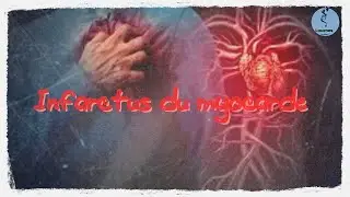 Infarctus du Myocarde:Causes, Symptômes et Traitement -Interview avec le Prof. Jamal Eddine Nibouch