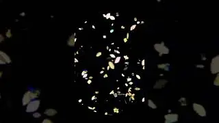 🌌Cristales de ácido úrico en sedimento urinario bajo microscopía de luz polarizada y campo claro.