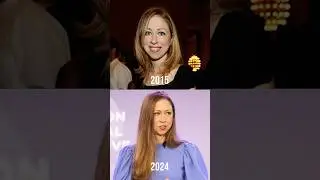 Chelsea Clinton’s Plastic Surgery Rumors… Reviewed by Plastic Surgeons!