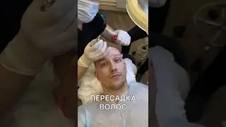ПЕРЕСАДКА ВОЛОС Hair Hub Clinic