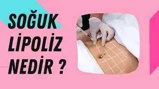 Soğuk Lipoliz Nedir? Ne İşe Yarar?
