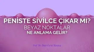 Peniste Sivilce Çıkar Mı? Beyaz Noktalar Ne Anlama Gelir? - Prof. Dr. Ömer Faruk Karataş