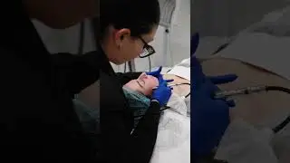 Microdermabrasion Facial