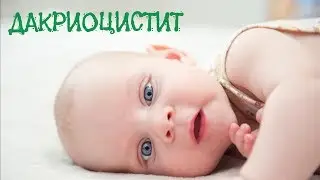 Baby's eyes are festering | Dacryocystitis in newborns | Lacrimal duct massage