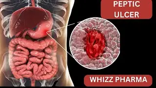 GASTRO INTESTINAL PATHO PHYSIOLOGY PART 3-PEPTIC ULCER