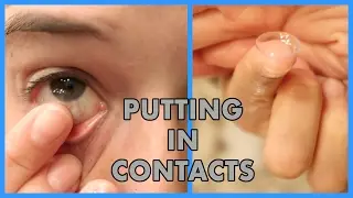 Putting in Contacts