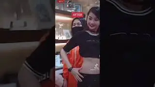 Alodia Gosiengfiao Liposuction Reaction plus tips